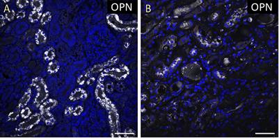 Osteopontin Expression in Cardiomyocytes Is Increased in Pediatric Patients With Sepsis or Pneumonia